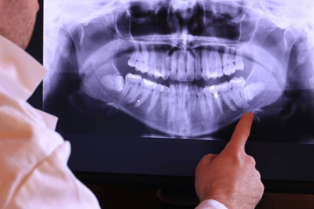 Best Emergency Broken Tooth Repair in Corinth, MS