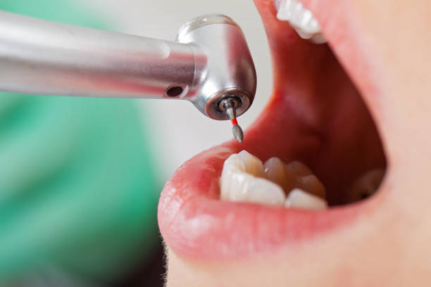 Best Emergency Treatment for Toothache in Corinth, MS
